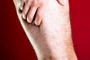 سیاتیک چیست و چه علائمی دارد؟