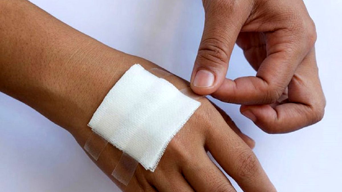 کنترل عفونت زخم با فناوری‌های جدید
