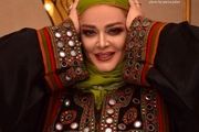 چهره دگرگون شده «بهاره رهنما»/ عکس