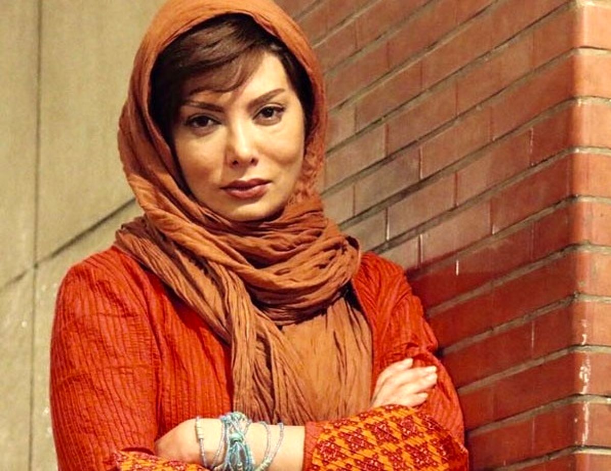 ماجرای جراحی زیبایی خانم بازیگر که جنجال ساز شد