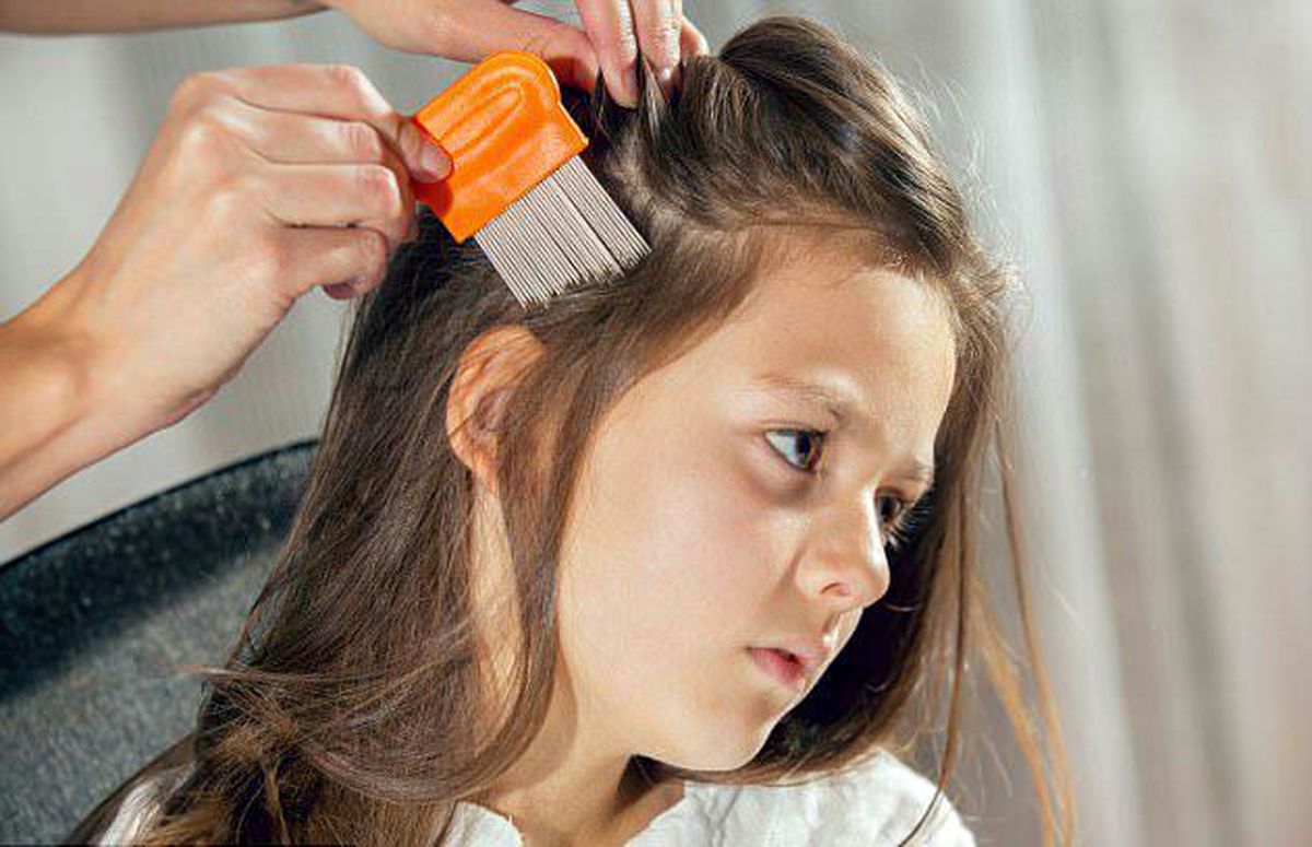 چگونه با شپش سر مقابله کنیم؟
