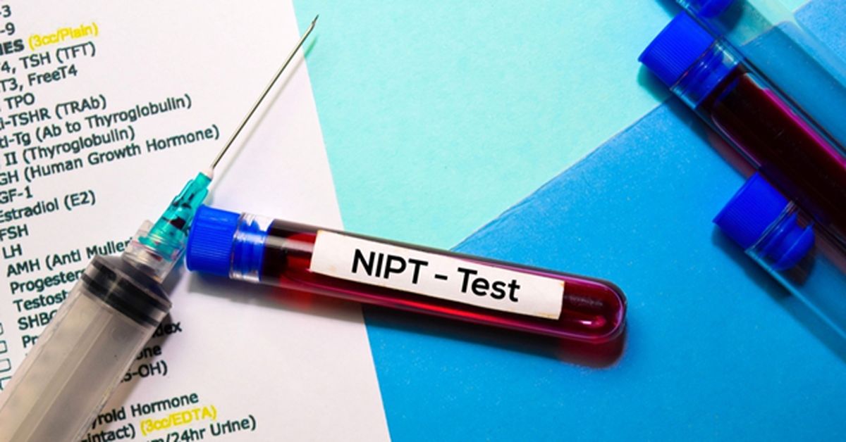 تشخیص اختلالات ژنتیکی قبل از تولد با آزمایش NIPT