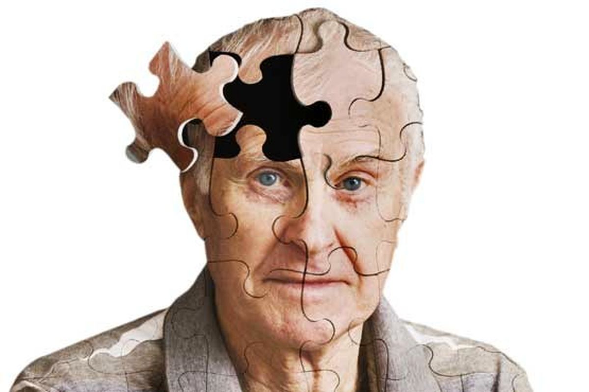 برای پیشگیری از آلزایمر این غذاها را بخورید