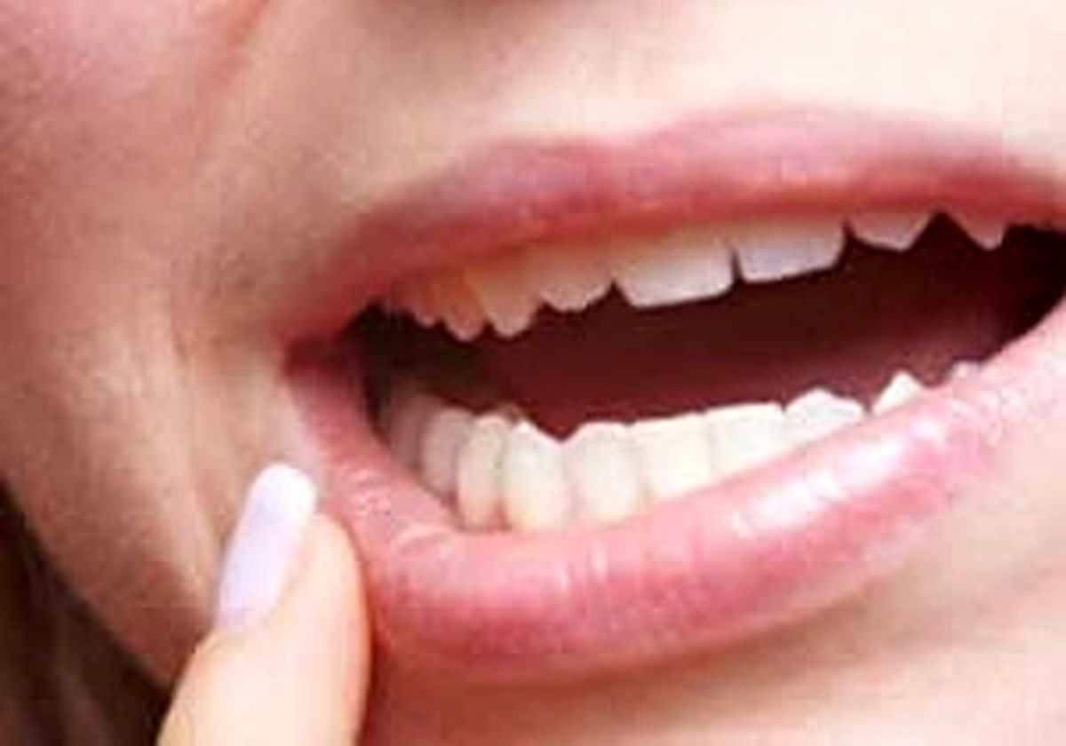 آب نمک بهتر است یا دهانشویه؟
