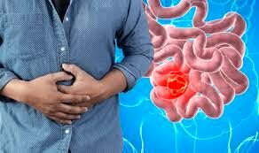 نفخ معده ای که نشان از سرطان است!