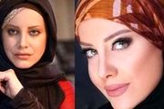 بازیگرانی که جراحی زیبایی آنها سروصدای زیادی کرد/تصاویر