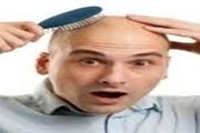 علل ریزش موی سکه‌ای