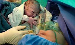 تاثیر کرونا بر زایمان زودرس