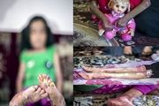 مرگ خاموش کودکان جنوب کرمان/تصاویر ۱۸+