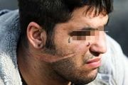 چاقو کشی بر روی مامور پلیس راهور