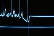  همه چیز درباره مرگ ناگهانی قلبی در جوانان 