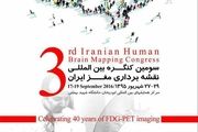 کنگره بین‌المللی نقشه‌برداری مغز برگزار می‌شود