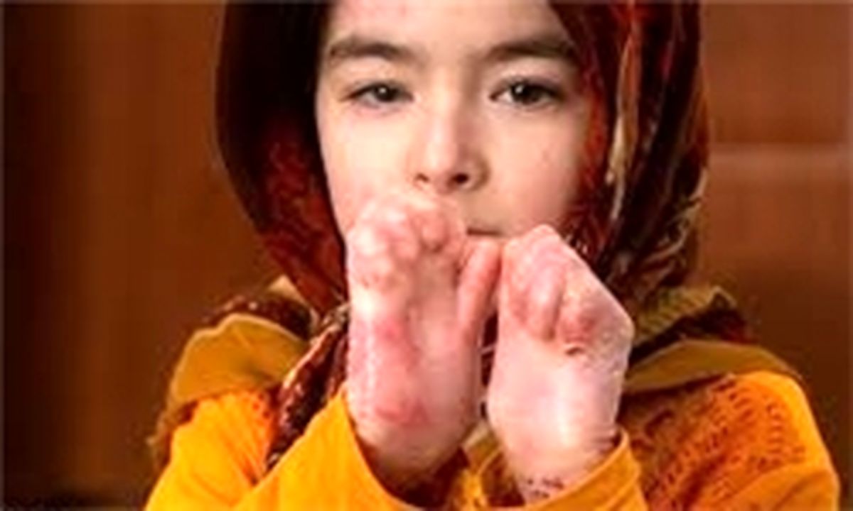 ازدواج فامیلی مهم ترین دلیل پروانه ای شدن