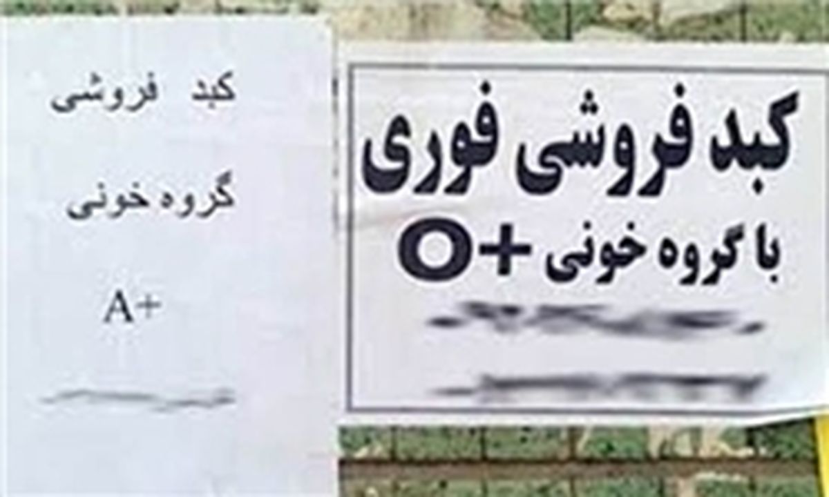 فروش کبد ۵۰۰ میلیونی در پایتخت