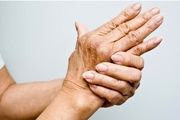 دست هایتان از سلامت شما چه می گویند
