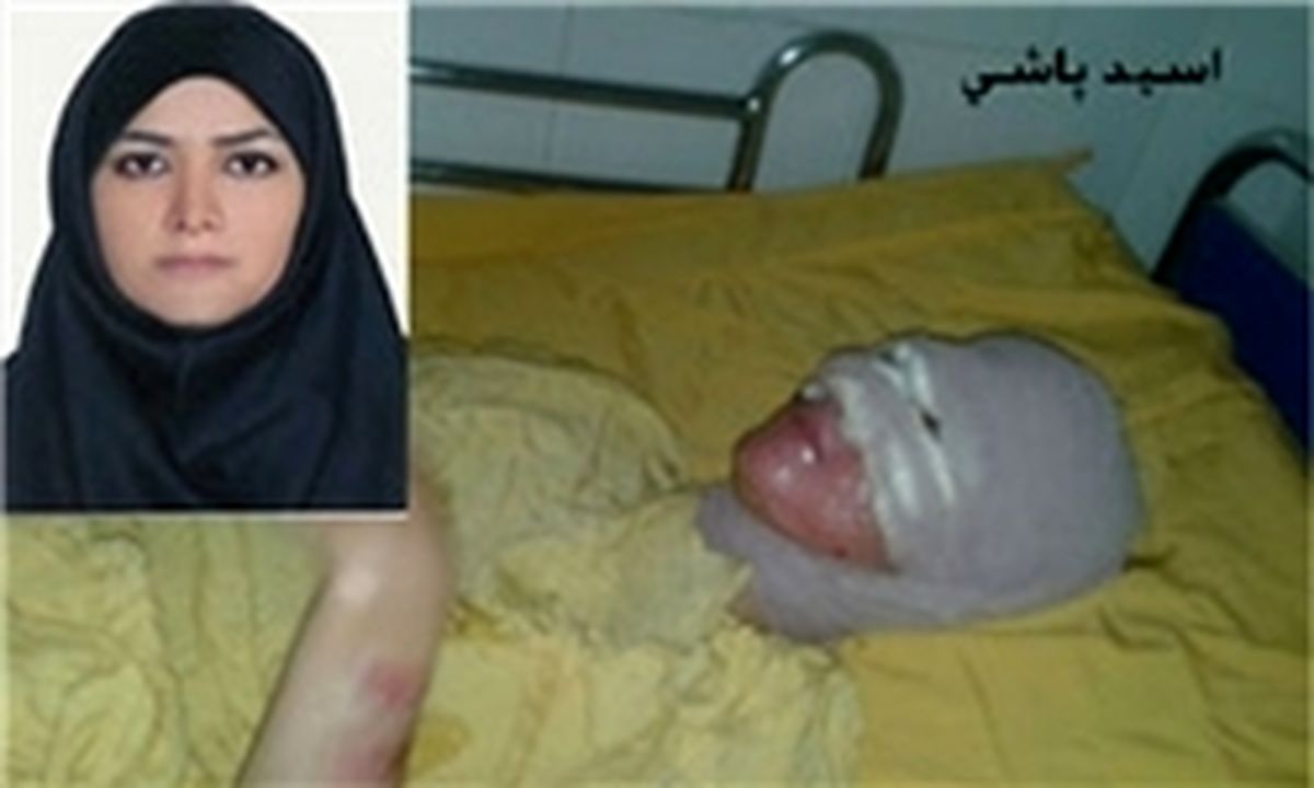 دومین جلسه دادگاه رسیدگی به پرونده اسیدپاشی