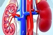 نشانه های خاموش عفونت کلیه را بشناسید
