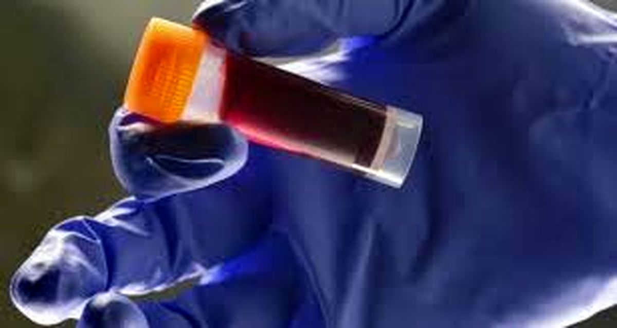 اگر این گروه خونی را دارید، خطر سکته زودرس در کمین شماست
