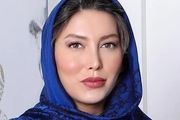 
تفاوت چهره فریبا نادری قبل و بعد از جراحی زیبایی
