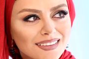 تغییر چهره ناگهانی شبنم فرشادجو /عکس
