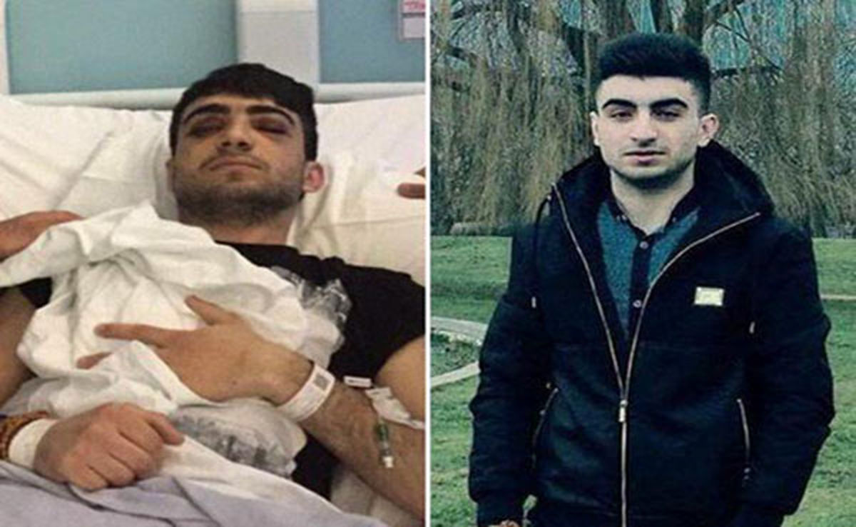تصویری از وضعیت نوجوان ایرانی قربانی حمله نژادپرستانه