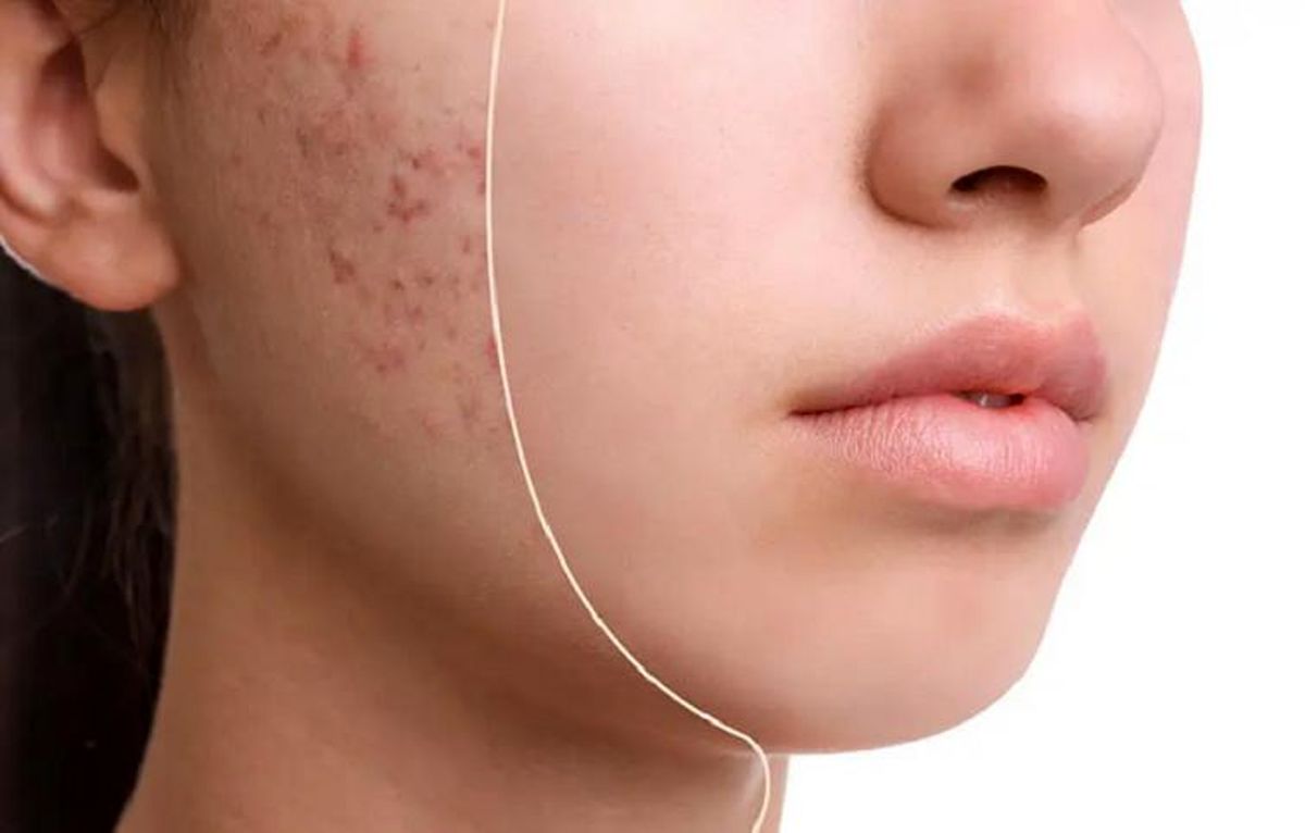 جوش‌ها به ما چه می‌گویند؟
