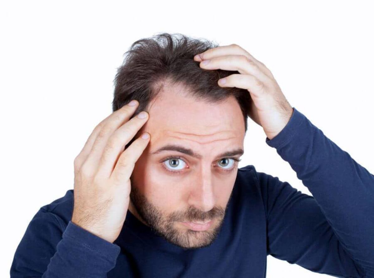 با این روش جدید دیگر نگران ریزش موهایتان نباشید!+جزئیات
