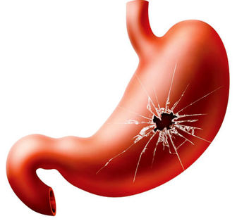 شرایط روزه داری افراد مبتلا به زخم معده
