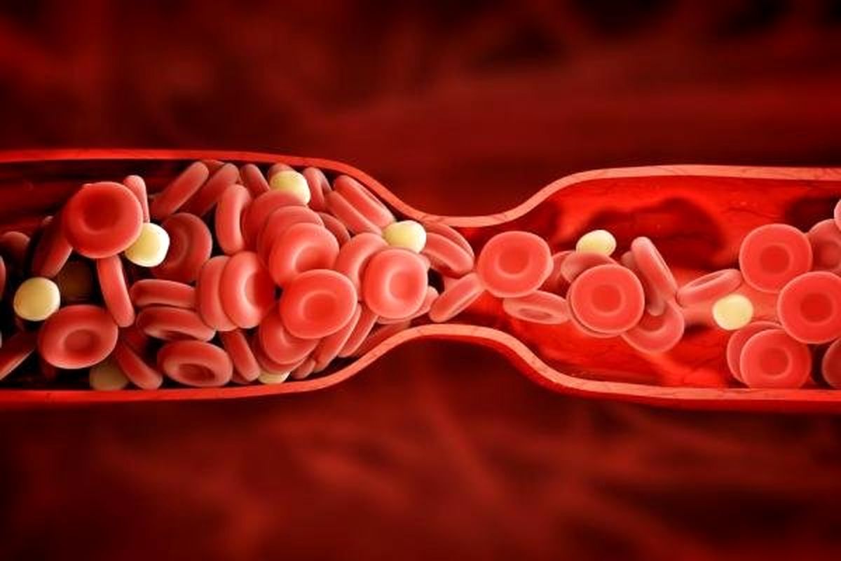 دلایل فقر آهن در بدن را بشناسید