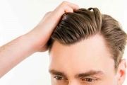 جدیدترین روش های کاشت مو در جهان را بشناسید
